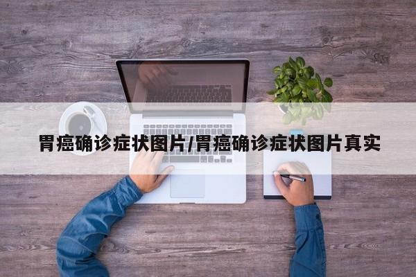 胃癌确诊症状图片/胃癌确诊症状图片真实